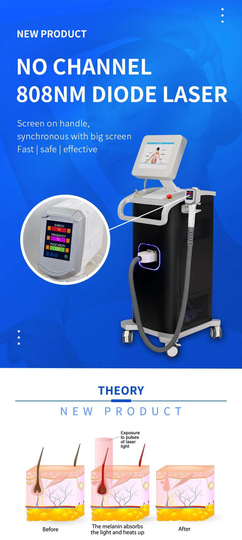 New Design Diode Laser 808nm Hair Removal/Laser Hair Machine Diode Laser/Laser Epilator Product